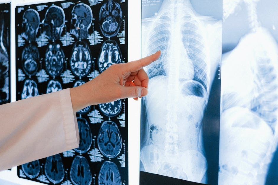 Photo of someone pointing to lung x-rays in a laboratory.