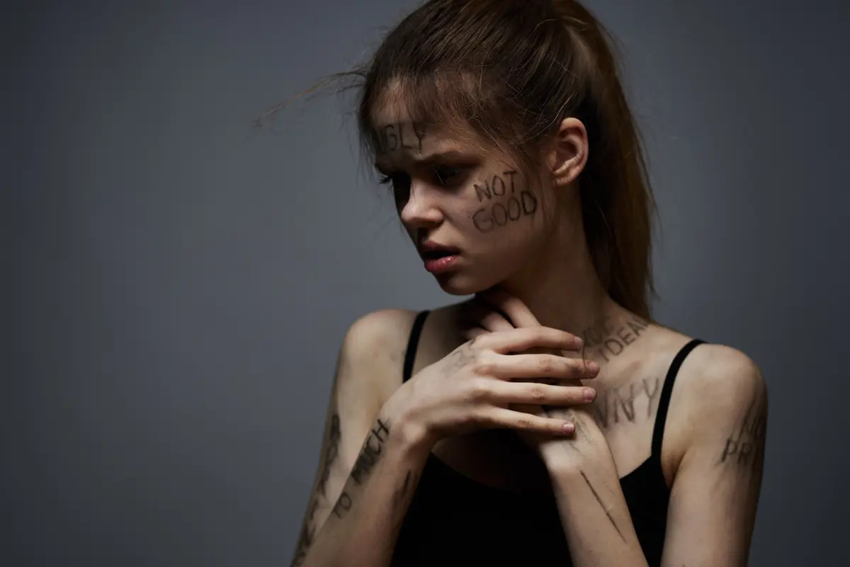 An emaciated woman shows some of the symptoms of meth addiction.