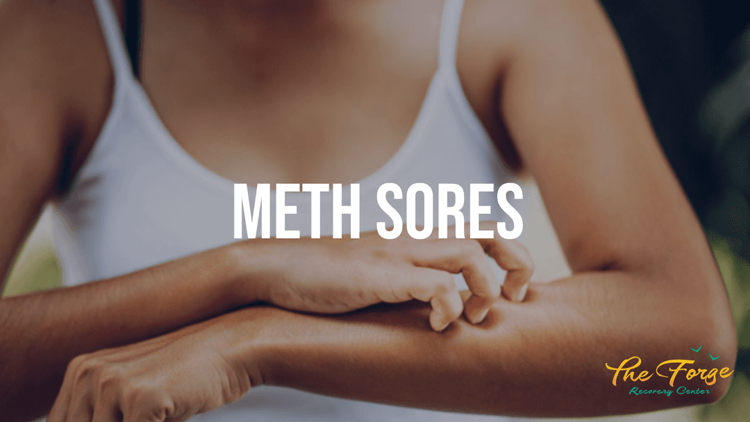 What are Meth Sores?