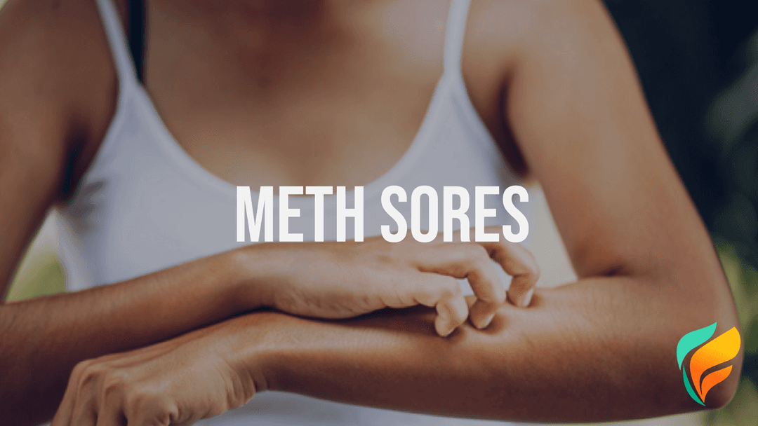 What are Meth Sores?