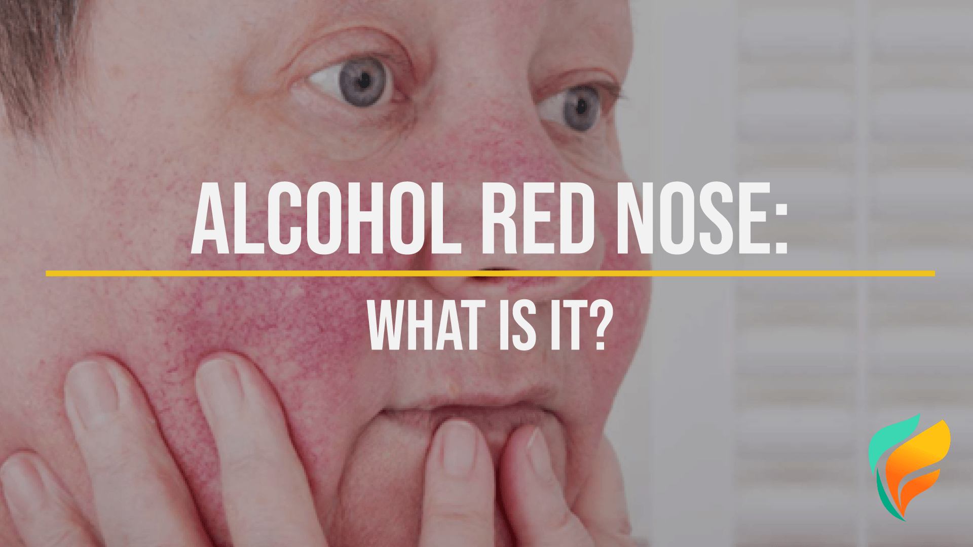 Alcohol Red Nose: Why Do So Many Drinkers Have Red Noses?