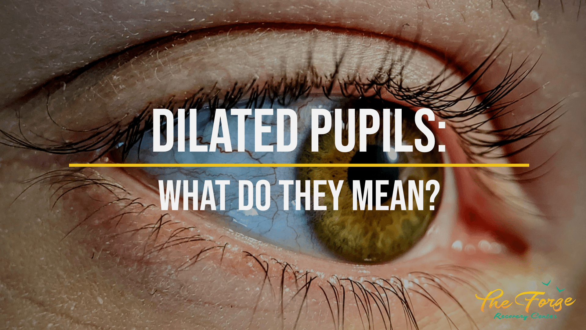 What Are Dilated Pupils?