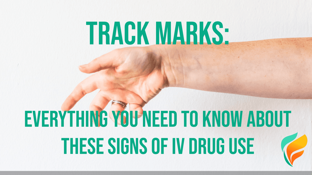 What are Track Marks?