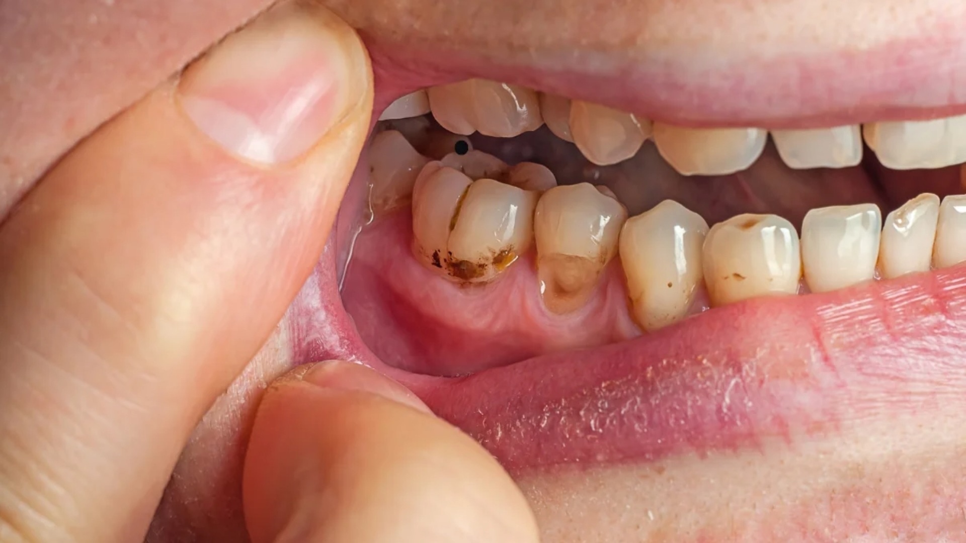 Identifying Meth What Does Meth Look Like? A Guide to Identifying Methamphetamine